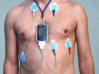 Ritim Holter Cihazı